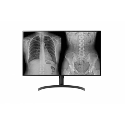 Monitor LG 32HL512D-B PC 80 cm (31.5")